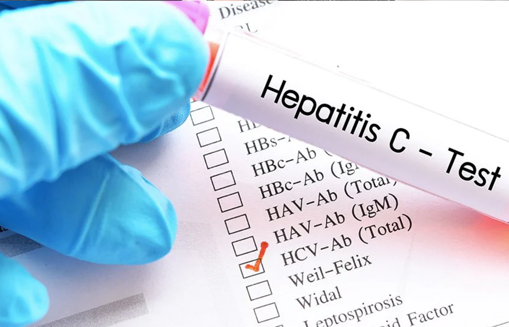 Test for Hepatitus C Infection in Tennessee is part of harm reduction